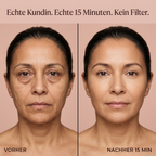Lumibella Kollagen Hydrogel Augenpads